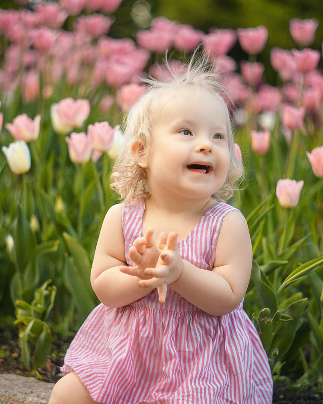 Mother captures AMAZING photographs of her adopted child with Down syndrome