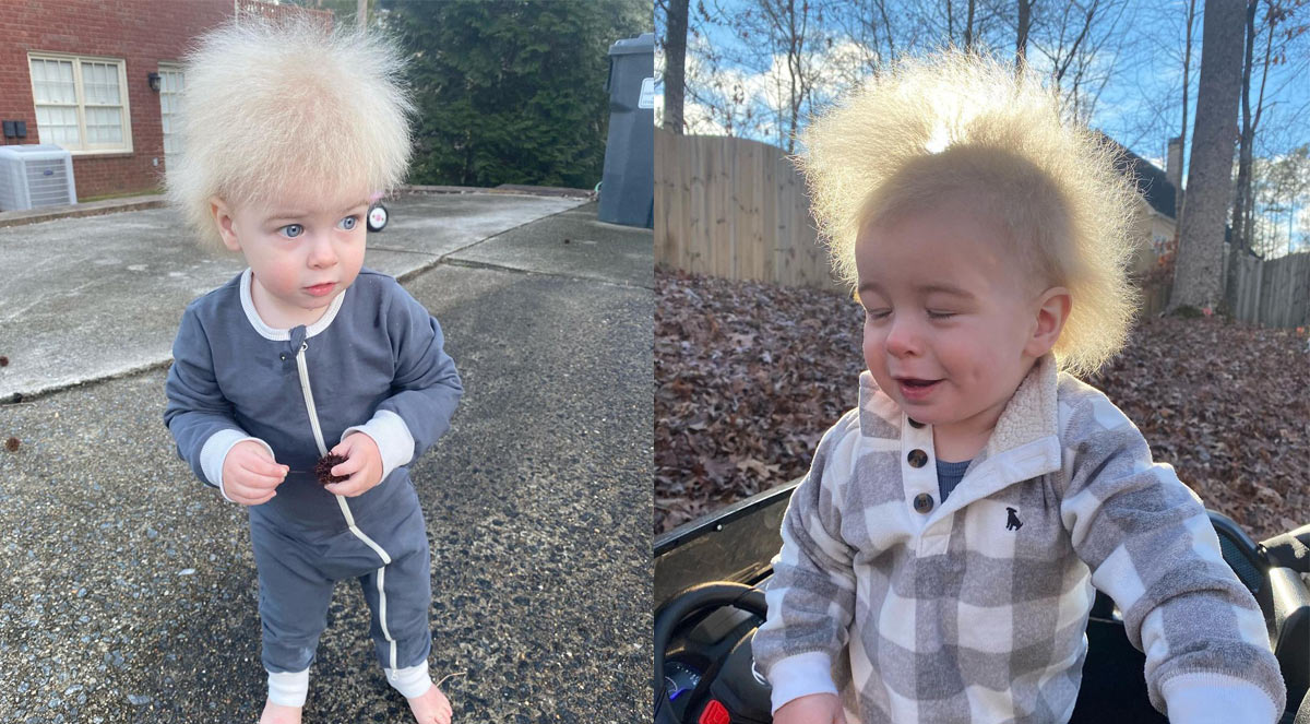 Mom raises awareness after discovering her son has ‘uncombable hair syndrome’