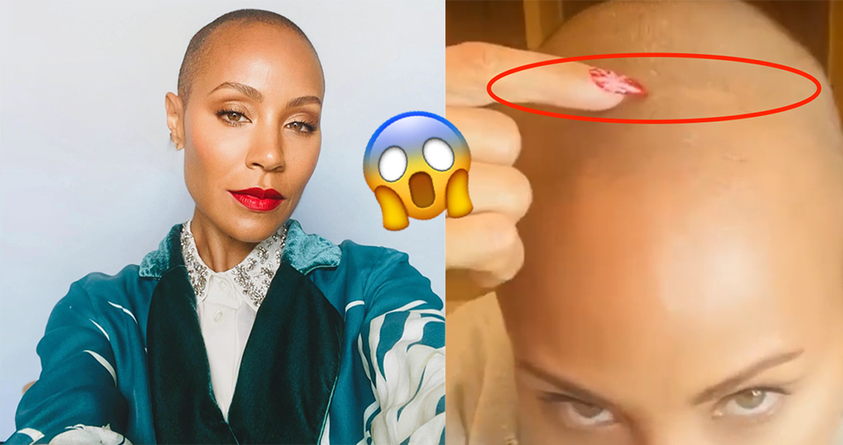 Viral footage of Jada Pinkett Smith ‘proves’ she is lying about having alopecia