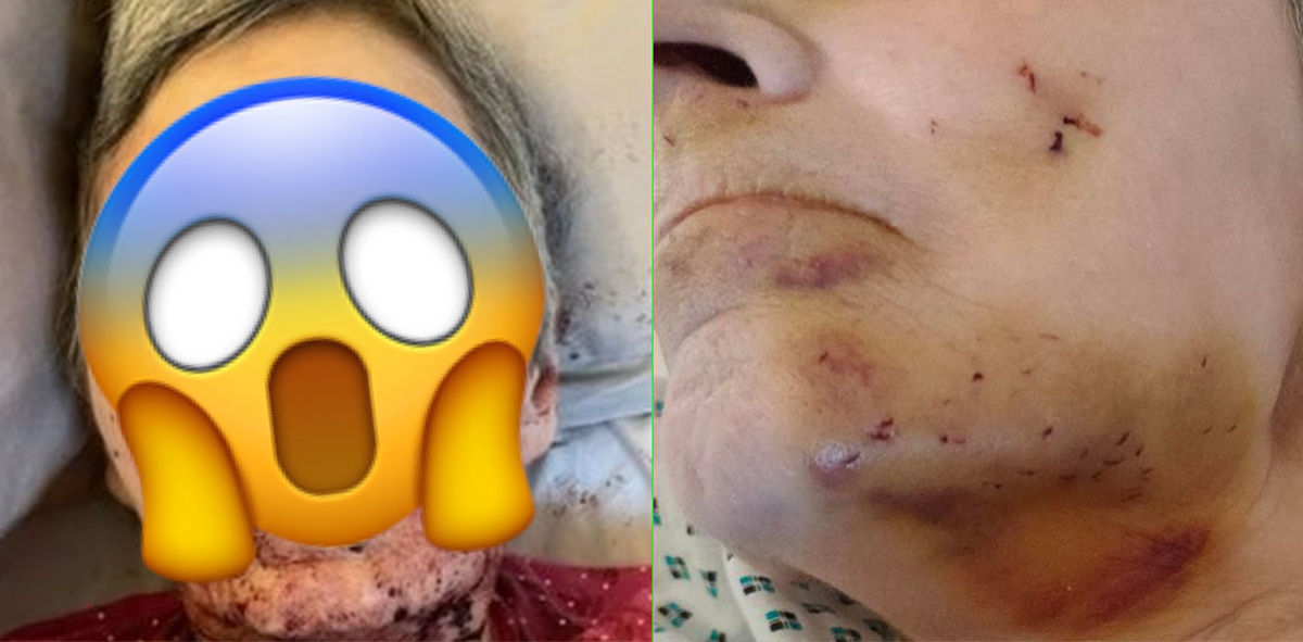 Disabled woman savagely attacked by rat that ‘gnawed’ at her face while she slept