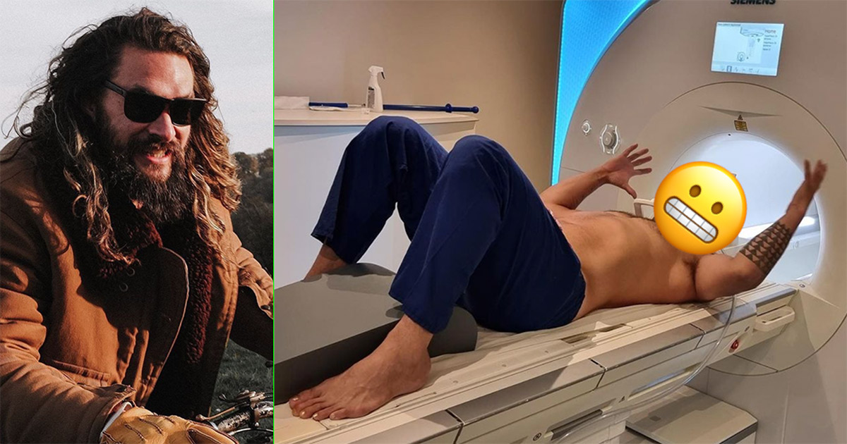 Jason Momoa worries fans with MRI scan on Instagram. What happened to him?