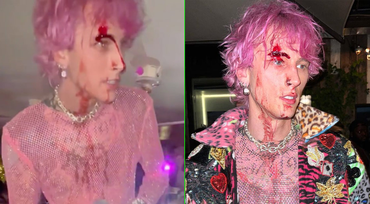 Machine Gun Kelly smashes glass on his face and performs while bleeding