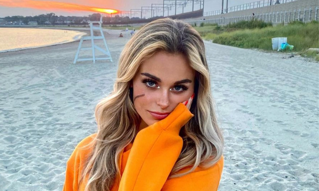 Who is Scar Girl? Is her scar real? Everything you need to know about the latest TikTok conspiracy