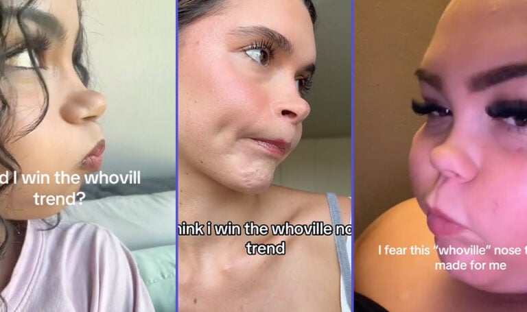 Why do people want a nose like the Grinch? The Whoville TikTok trend explained
